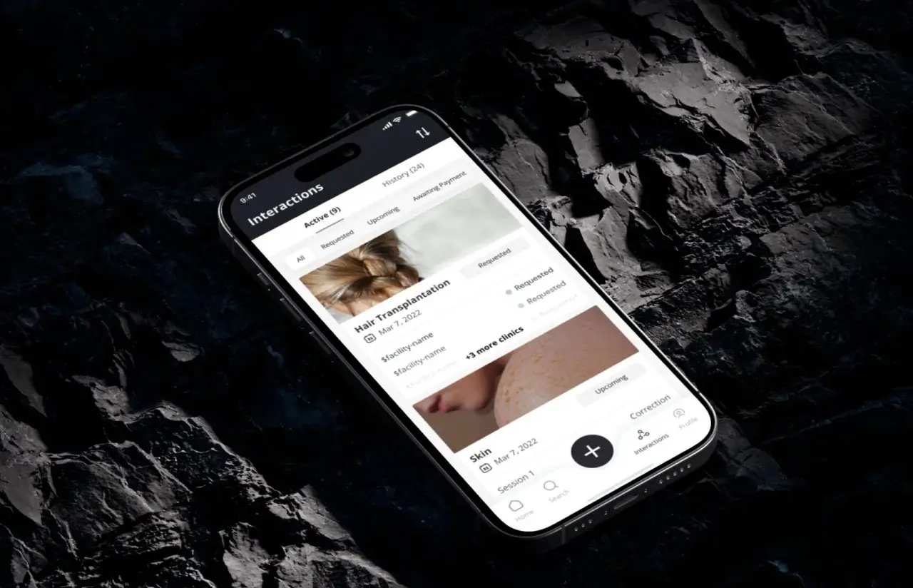 A phone showing the Interactions screen of the patient app with nine active requests: a hair transplantation request marked Requested across three more clinics, and a skin correction session marked Upcoming, with tabs for active, upcoming and awaiting payment