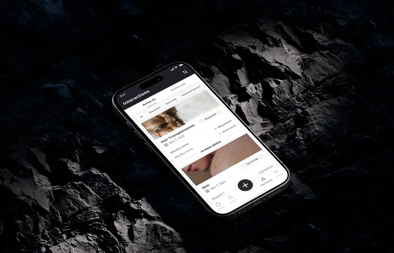 Beauty Lab mobile app showing the Interactions screen with hair transplantation and skin treatment requests