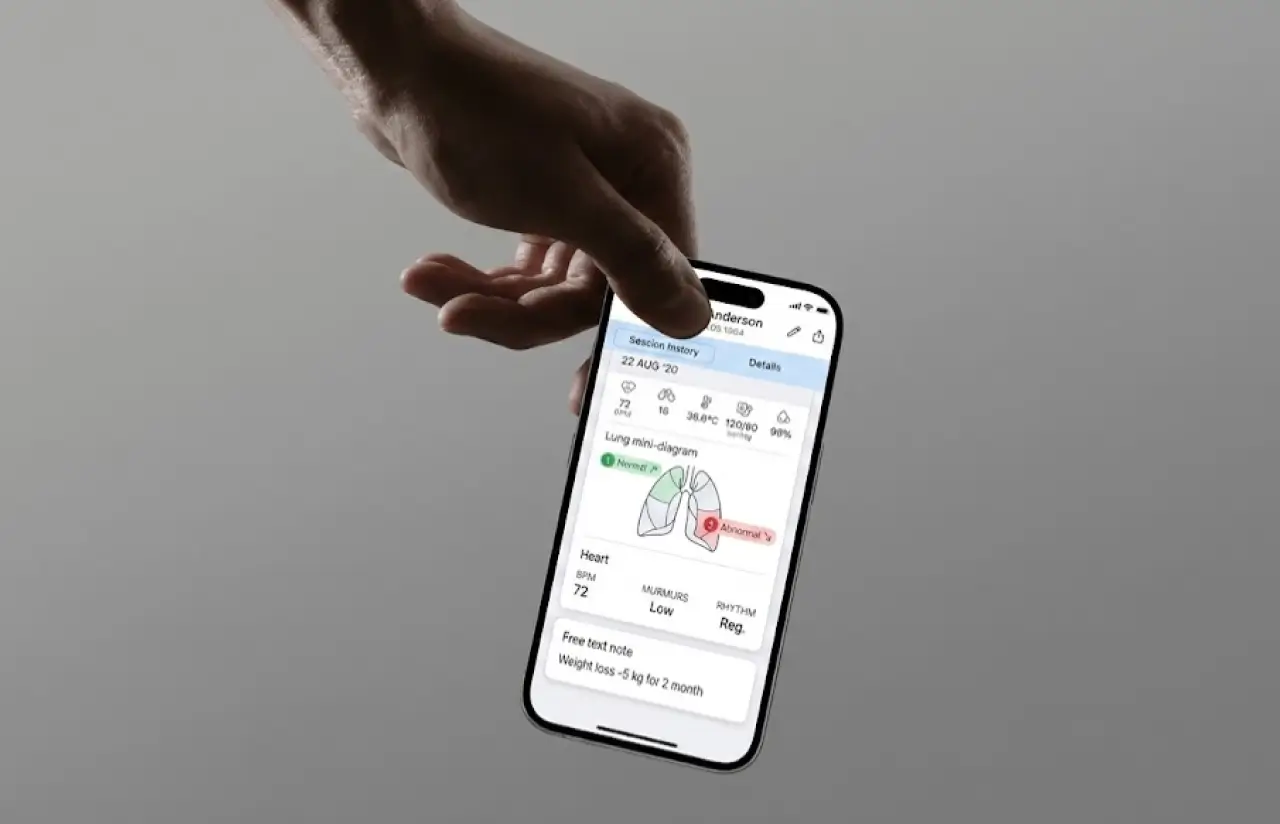 A hand holding a phone showing session history for a patient: vitals across the top, a lung mini-diagram with one zone normal and one abnormal, heart readings and a free text note about weight loss